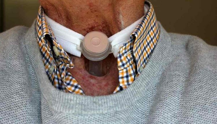 Misdiagnosis of Larynx Cancer