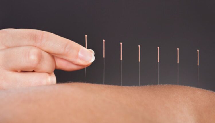 acupuncture fertility treatment dubai