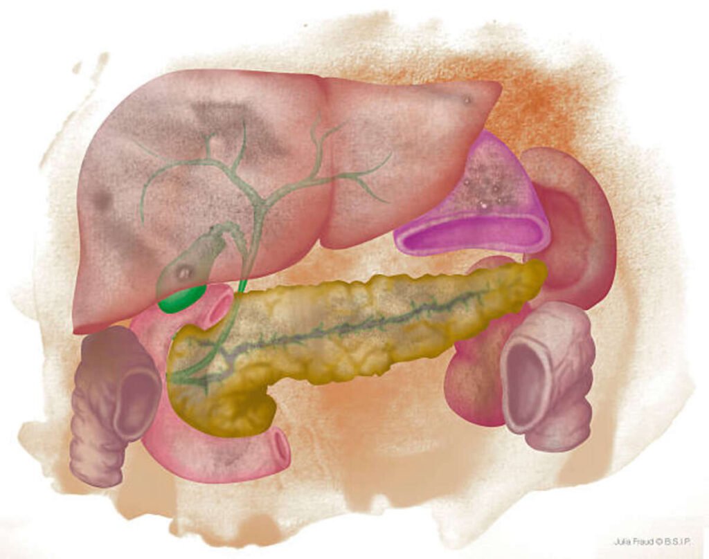 pancreatic cancer