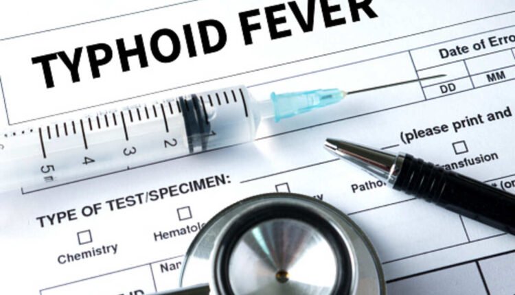 typhoid fever